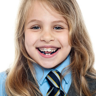 orthodontic retention